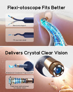 Bebird Earsight Plus R37R Ear Camera Otoscope

