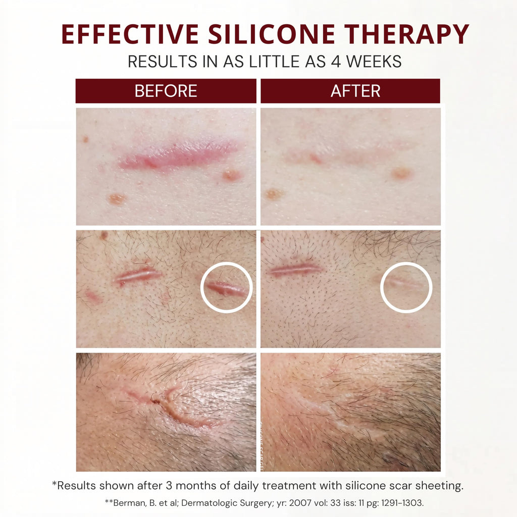 HealFast Silicone Scar Gel & Cream - Medical Grade Treatment

