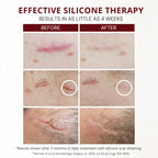 HealFast Silicone Scar Gel & Cream - Medical Grade Treatment

