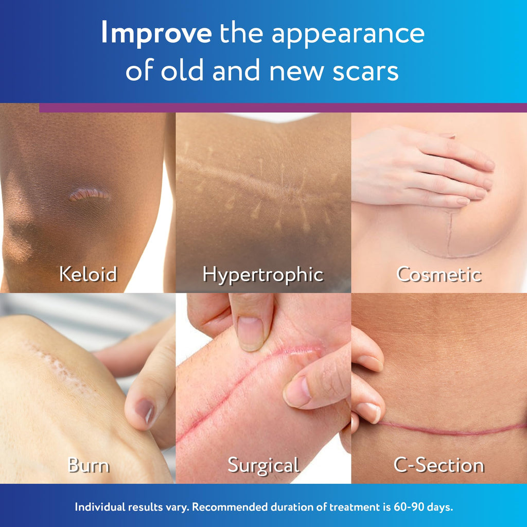 ScarAway Silicone Scar Gel for Hypertrophic & Keloid Scars

