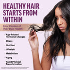 Hair Growth Accelerator by Force Factor | Vitamins

