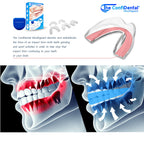 ConfiDental Anti Grinding Guard Moldable Night Mouth Guard

