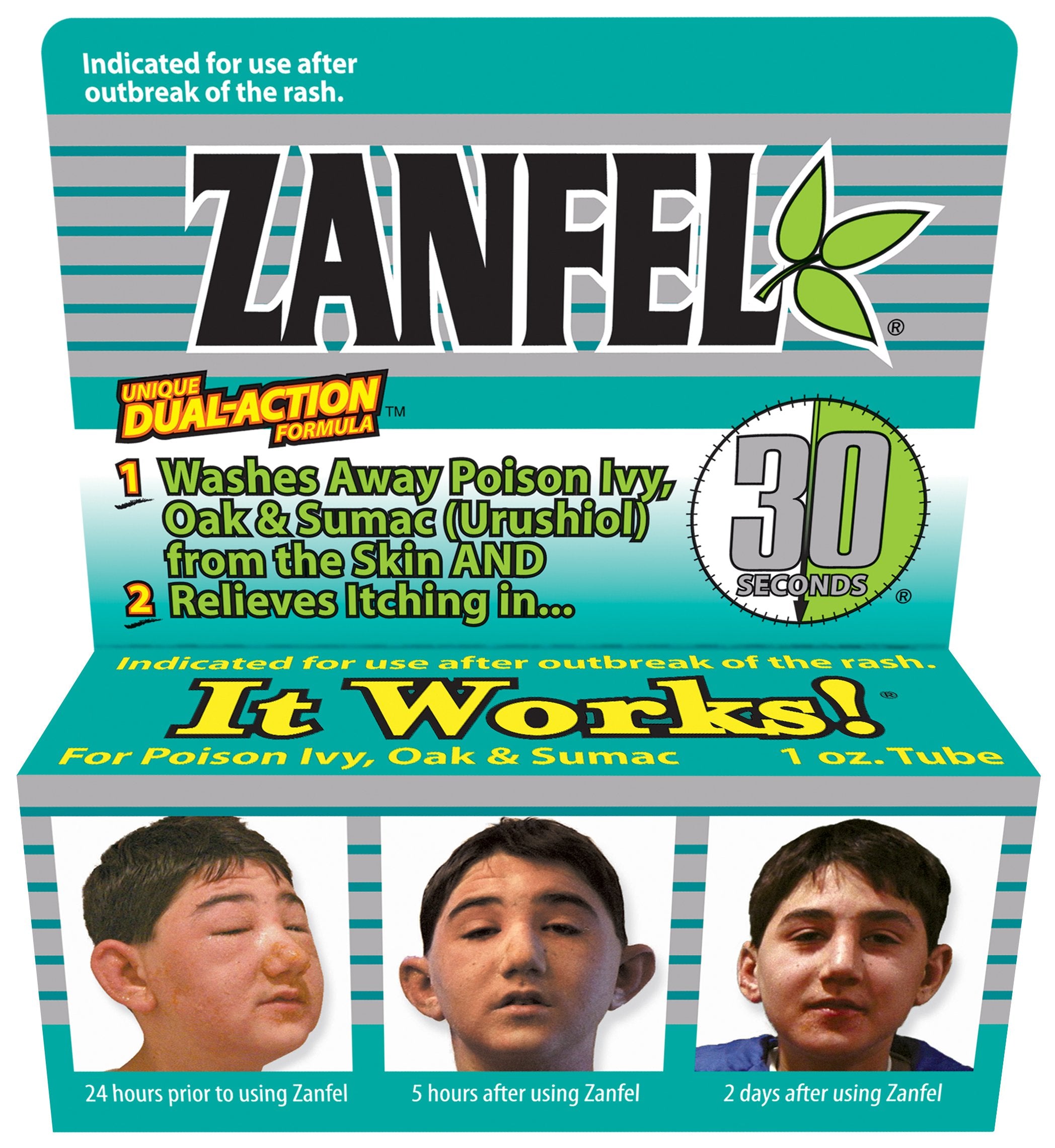 ZANFEL Poison Ivy Wash Topical Solution | Fast Relief

